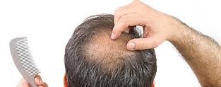 HEALTHY DIET Ervamatin is a 100% natural product, that extracts its powers from nature to help you in having a growing, shinny, beautiful hair. And as we use nature’s power...